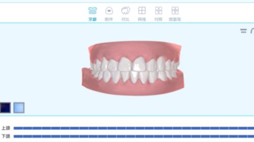 毛利高達70%，隱形牙套的千億市場，誰在買單？